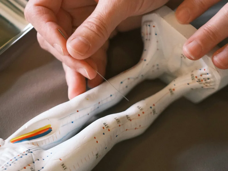 Acupuncture at The Lab Chiropractic in Charles