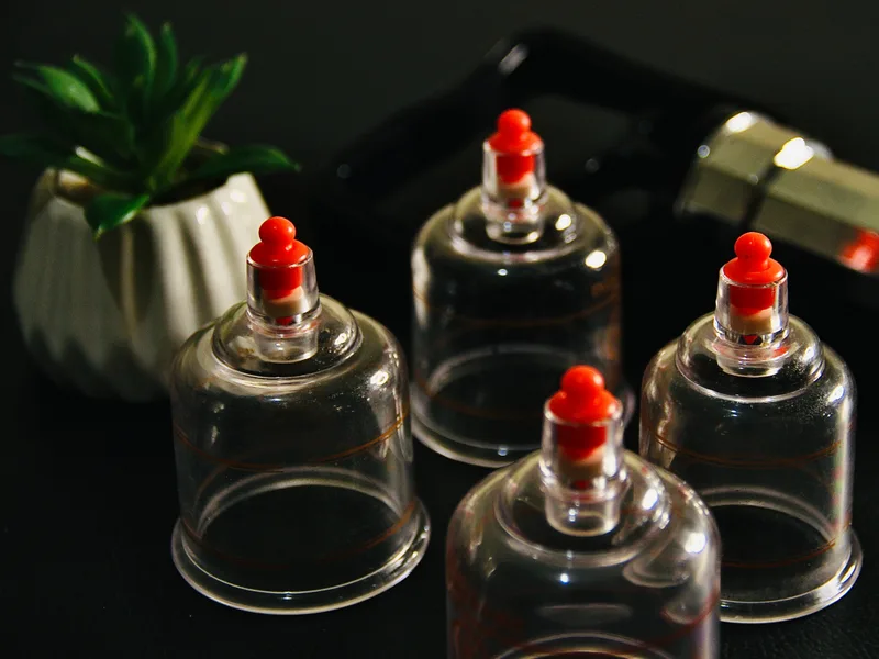 How Cupping Therapy works at The Lab Chiropractic
