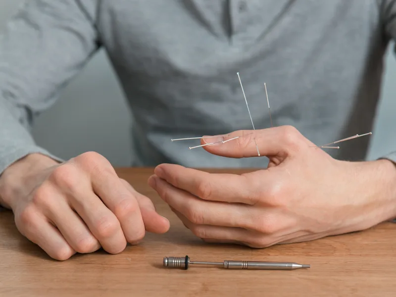 Dry Needling at The Lab Chiropractic in Charles